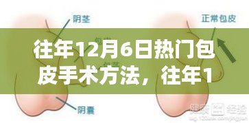 往年12月6日热门包皮手术方法及最新技术与护理指南解析