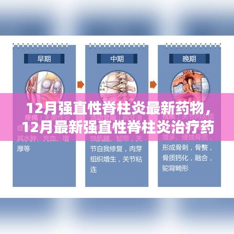 12月强直性脊柱炎最新治疗药物进展概览