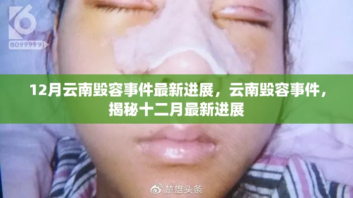 揭秘云南毁容事件最新进展，十二月更新动态