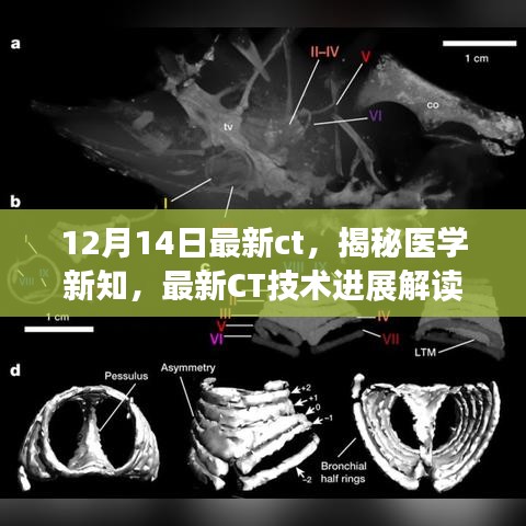 最新CT技术进展解读，医学新知揭秘（12月14日更新版）