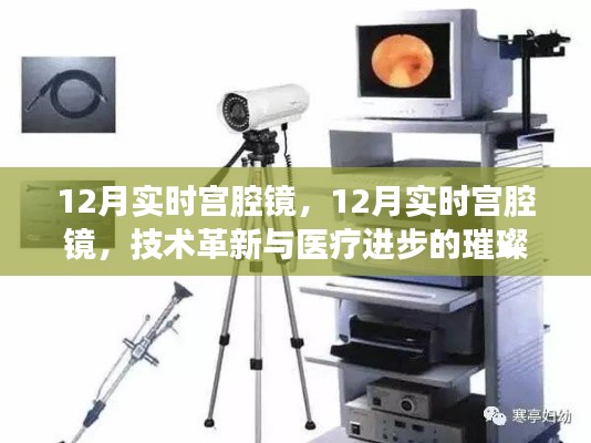 12月实时宫腔镜技术革新，医疗进步的璀璨篇章