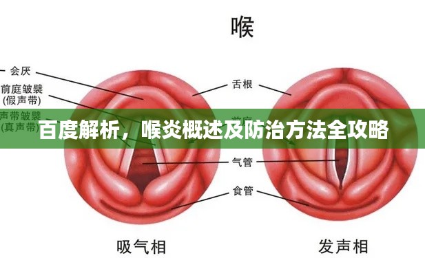 百度解析，喉炎概述及防治方法全攻略